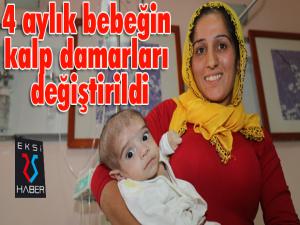 4 aylık bebeğin kalp damarları değiştirildi