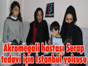 Akromegali hastası Serap tedavi için İstanbul yolcusu 