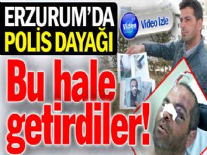 Erzurum'da öldüresiye polis dayağı!