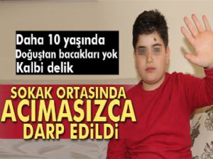 Doğuştan bacakları olmayan küçük Miraç, şehir magandalarının hedefi oldu 