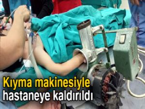 Kıyma makinesiyle hastaneye kaldırıldı