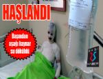 Üzerine kaynar su dökülen 8 çocuk annesi kadın yandı 