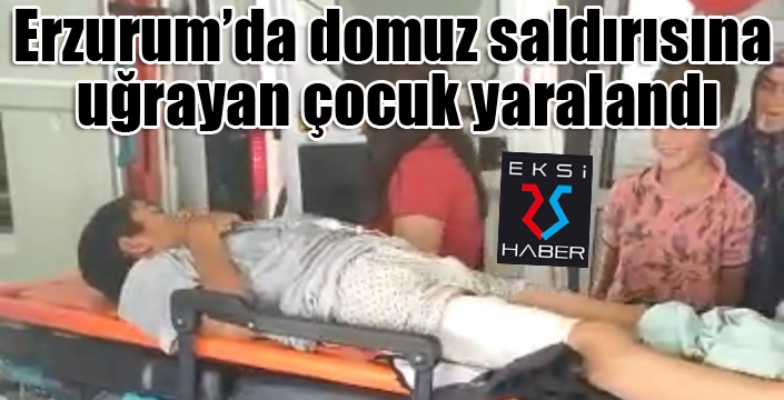 Domuz saldırısına uğrayan çocuk yaralandı