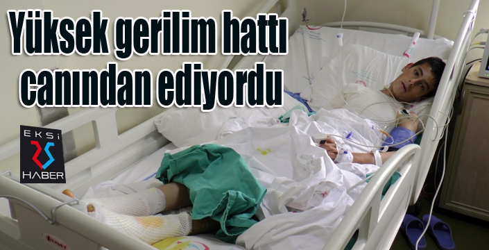 Yüksek gerilim hattı az kalsın canından ediyordu